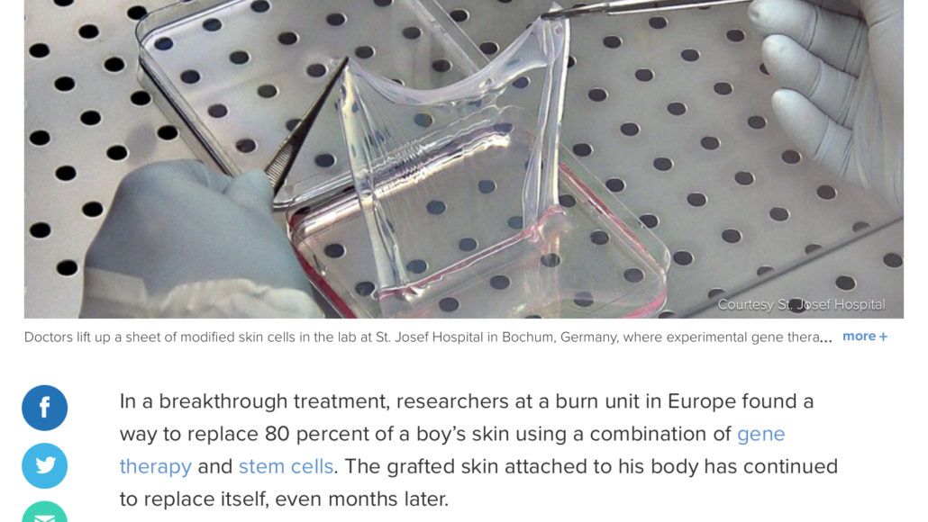 Skin culture combined with gene therapy leads to a breakthrough treatment.