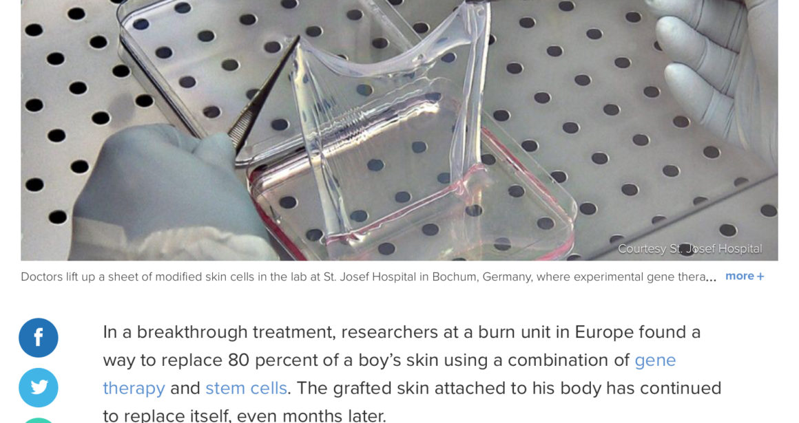 Surgeons find breakthrough skin treatment